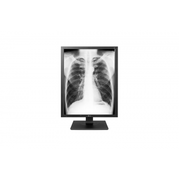 Монитор 21.3 LG 21HK512D-B IPS 1000CD